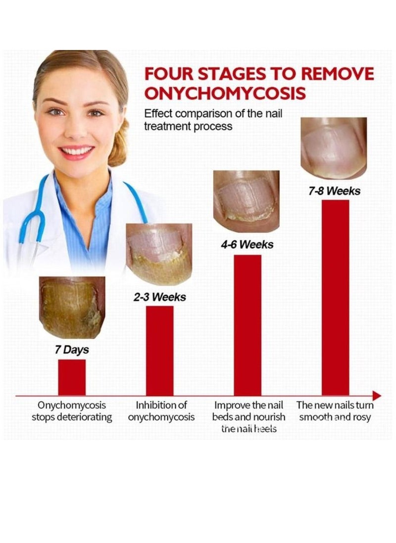 Vibrant Glamour - Professional Onychomycosis & Fungus Nail Treatment Solution - 15ml - Image 1