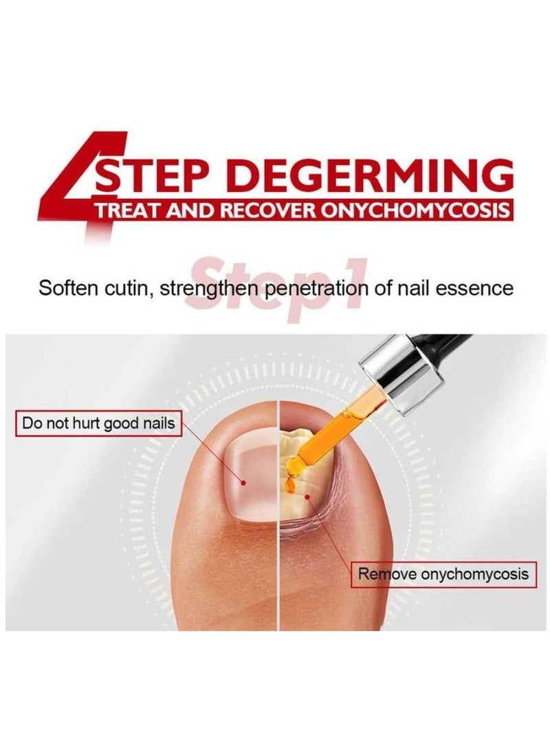 Vibrant Glamour - Professional Onychomycosis & Fungus Nail Treatment Solution - 15ml - Image 1