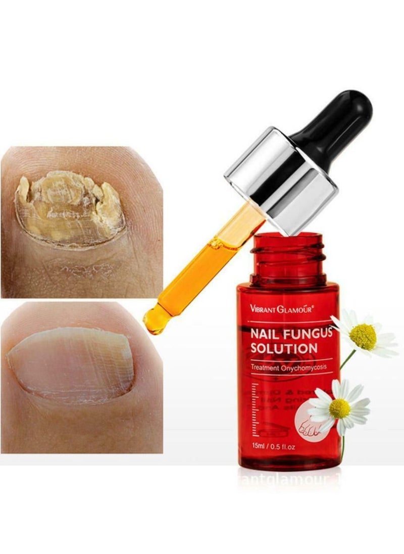 Vibrant Glamour - Professional Onychomycosis & Fungus Nail Treatment Solution - 15ml - Image 1