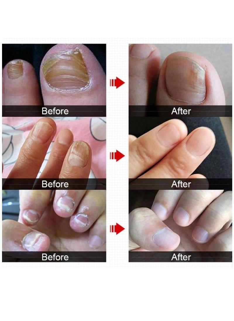 Vibrant Glamour - Professional Onychomycosis & Fungus Nail Treatment Solution - 15ml - Image 1