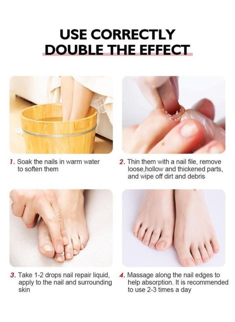 Vibrant Glamour - Professional Onychomycosis & Fungus Nail Treatment Solution - 15ml - Image 1