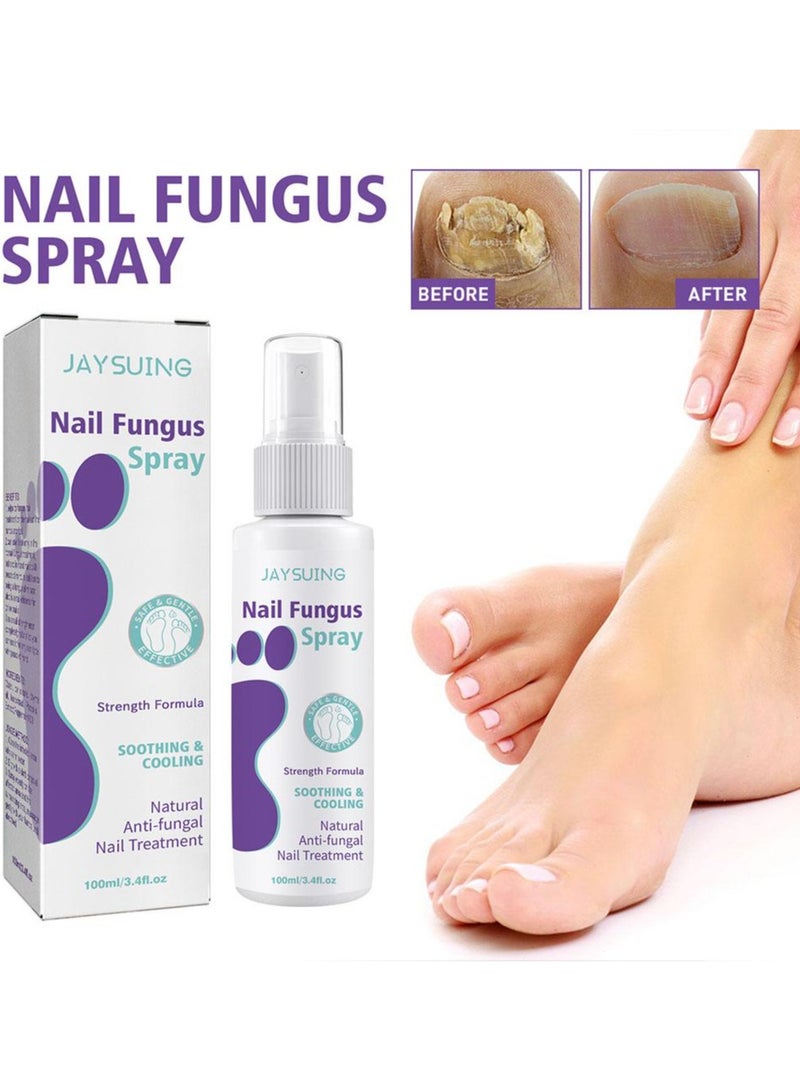 Jaysuing 100ml Nail Fungus Treatment Beauty Health Remedy Serum Essence Anti Paronychia Onychomycosis Fungus Removal Gel Foot Care - Image 3