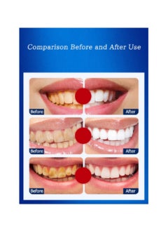 5D 5D White Teeth Whitening Strips Advanced Fast Effective 3 Days Significant Whitening Portable Comfortable Easy to Use 7Pcs/Pack  - Image 3