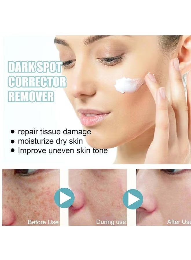 EELHOE Dark Spot Corrector For Face, Fast-Acting Dark Spot Corrector Remover For Face And Body Hyperpigmentation, Fades Melasma, Freckle, Sun Spots, Evens Skin Tone, Age Spot Remover - Image 5