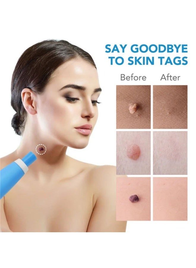 Skin tag removal pen - Image 3