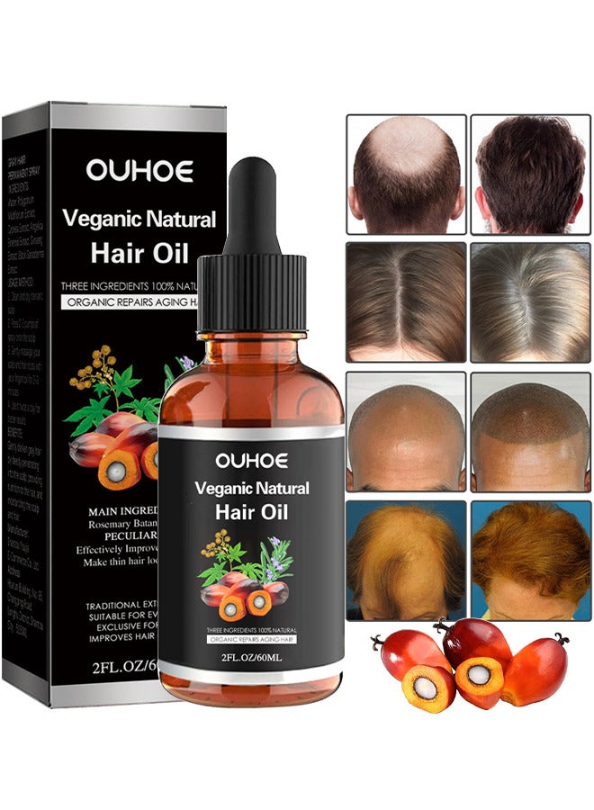 OUHOE Batana Oil For Hair Growth, Batana Oil Organic For Healthy Hair, 100% Natural Batana Oil Organic For Healthy Hair For Men And Women, Enhances Hair And Skin Radiance, Reduces Hair Loss, 60ML - Image 1