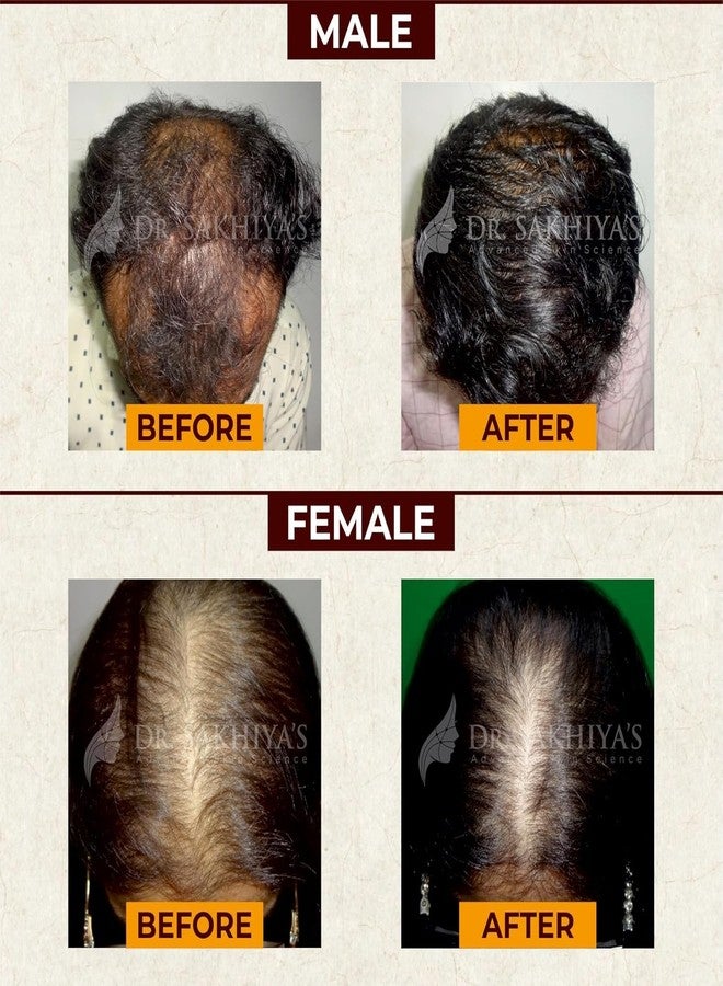 EDITH زيت إديث جاديبوتي للشعر، أملا، براهمي، برينجراج، جذر نجيل الهند، ومزيج من 18 زيتًا أيورفيديًا مثبتًا سريريًا، يقلل من تساقط الشعر وتقصفه، ويقوي الجذور، مناسب لجميع أنواع الشعر، 100 مل، عبوة من قطعتين - Image 5