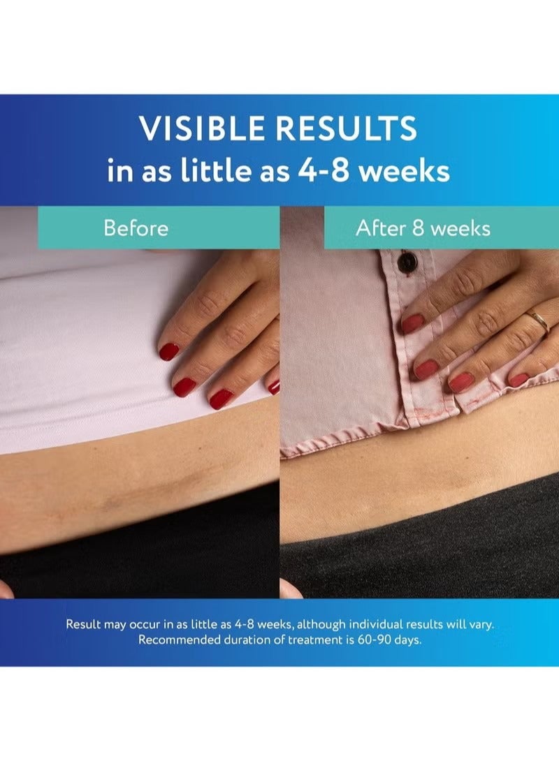 scaraway Clear Silicone Scar Sheets, White, 6 Count - Image 4