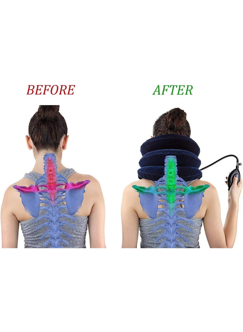 FALAHOM Adjustable Cervical Neck Traction, Portable  Air Inflation Neck Traction, Inflatable Neck Stretcher, Neck Decompression, Relief Traction Spine Alignment, Ergonomic Design, Home Use - Image 3