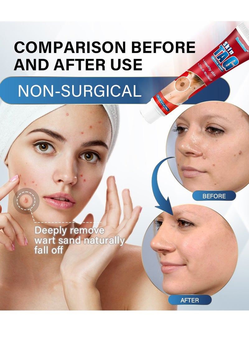 سوميفون كريم إزالة الوشم بالوور تي للعناية بالبشرة مرهم موضعي - Image 2