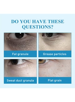SOUTH MOON Milia Remover Patch,Remove Fat Granule Eye Patch, Remove Oil Granule Eye Patch Under The Face, Nourish Eye Cream, Moisturize Repair and Smooth Eye Patch 144 Patch  - Image 2