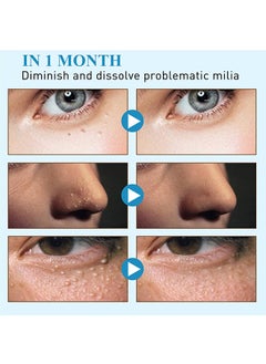SOUTH MOON Milia Remover Patch,Remove Fat Granule Eye Patch, Remove Oil Granule Eye Patch Under The Face, Nourish Eye Cream, Moisturize Repair and Smooth Eye Patch 144 Patch  - Image 5