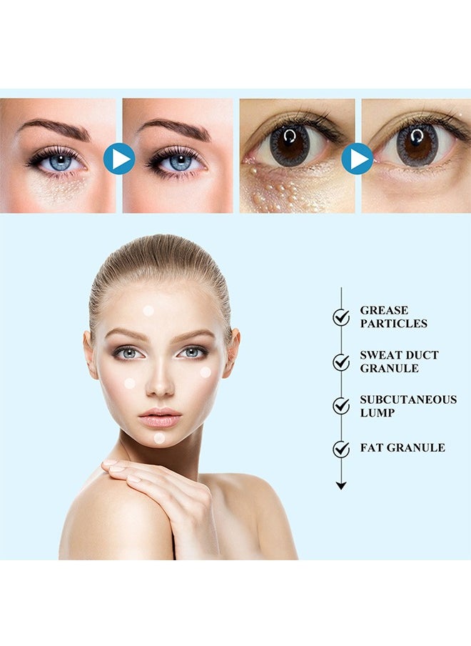 SOUTH MOON - Milia Remover Patch,Remove Fat Granule Eye Patch, Remove Oil Granule Eye Patch Under The Face, Nourish Eye Cream, Moisturize Repair and Smooth Eye Patch 144 Patch - Image 1