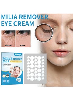 SOUTH MOON Milia Remover Patch,Remove Fat Granule Eye Patch, Remove Oil Granule Eye Patch Under The Face, Nourish Eye Cream, Moisturize Repair and Smooth Eye Patch 144 Patch  - Image 1