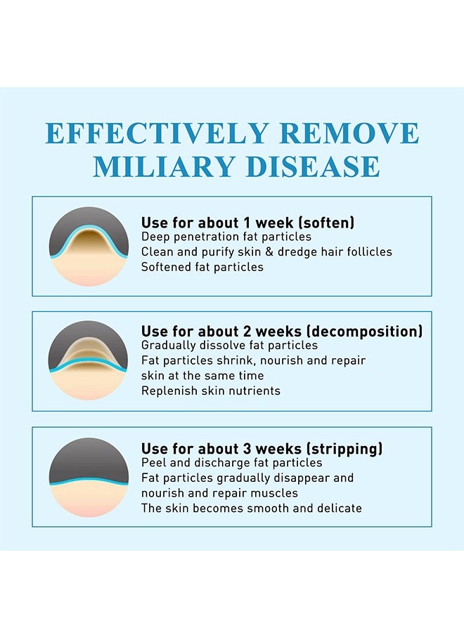 SOUTH MOON - Milia Remover Patch,Remove Fat Granule Eye Patch, Remove Oil Granule Eye Patch Under The Face, Nourish Eye Cream, Moisturize Repair and Smooth Eye Patch 144 Patch - Image 1
