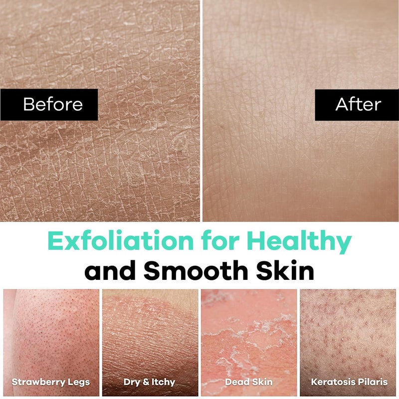 Dermasuri Deep Exfoliating Glove - Polishing Mitt Body Scrubber - Korean Skin Cleaner Exfoliator & Dead Skin Buffing Treatment - Keratosis Pilaris Scrub Remover- Shower Skincare (1 Pack) - Image 5