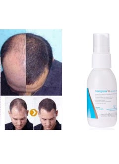 Dar Al Dawa Minoxidil 5% Solution Hair Regrowth Tonic 50ml (2 Pack 2 Month)  - Image 2