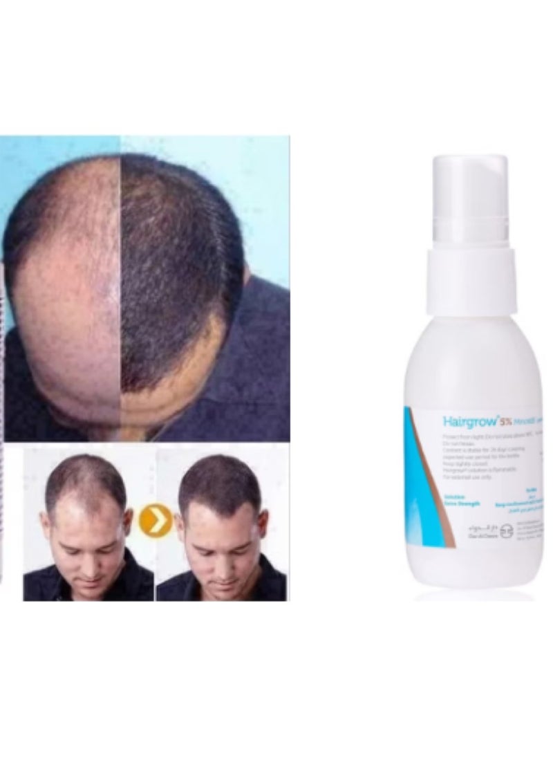 Dar Al Dawa Minoxidil 5% Solution Hair Regrowth Tonic 50ml (2 Pack 2 Month)  - Image 2