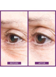 PRAI Beauty Ageless Eye Tight Uplift Serum, Anti-Aging and Hydrating Eye Serum, For Instantly Ageless Brow and Eyelid Area, 0.5 Oz  - Image 2