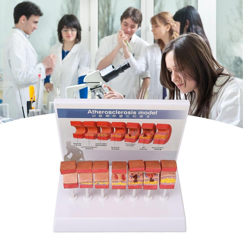klarako 7PCS Artery Anatomy Model,Simulation Doctors Office Display for Educational Tool Teaching Tools, with Practical Safe Material - Image 4