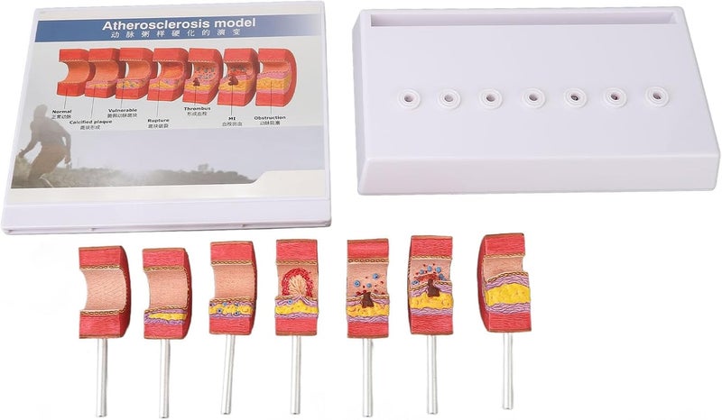 klarako 7PCS Artery Anatomy Model,Simulation Doctors Office Display for Educational Tool Teaching Tools, with Practical Safe Material - Image 3