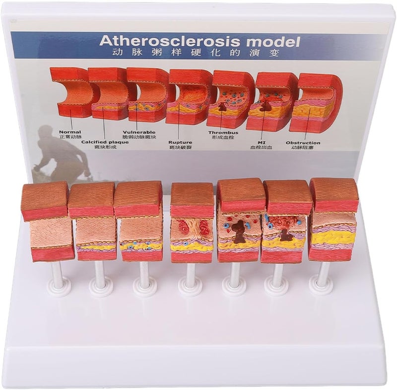 klarako 7PCS Artery Anatomy Model,Simulation Doctors Office Display for Educational Tool Teaching Tools, with Practical Safe Material - Image 1