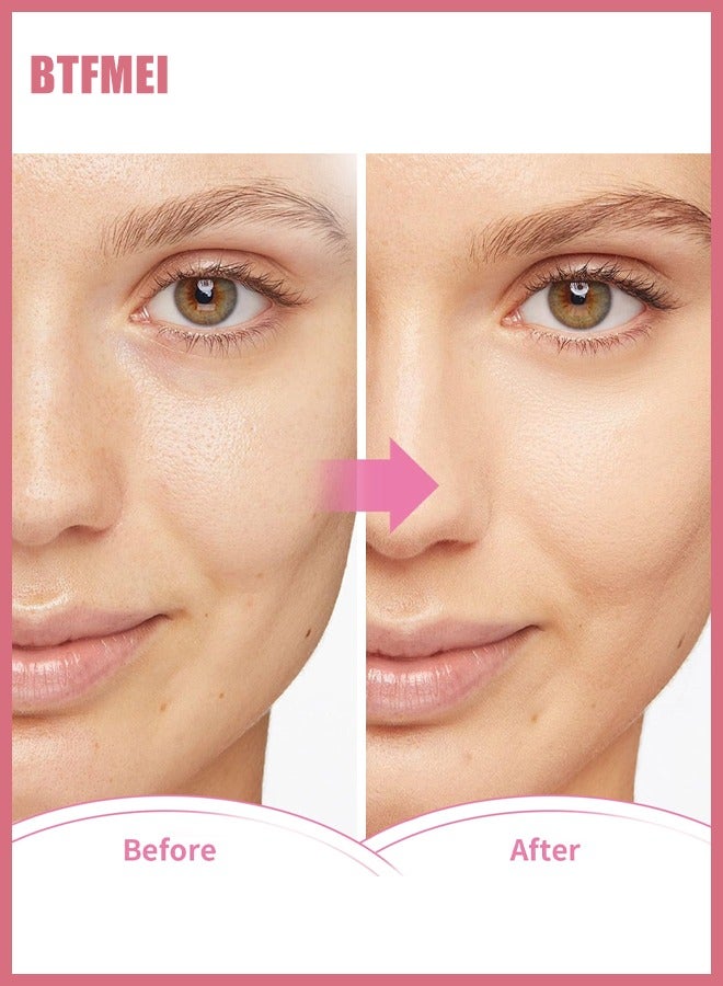 BTFMEI Face Eye Mask Ice Pack for Reducing Puffiness, Bags Under Eyes, Puffy Dark Circles, Migraine,Hot/Cold Pack with Soft Plush Backing  - Image 4
