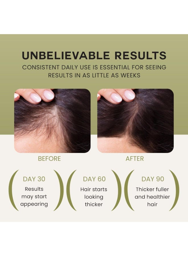 Lebanta Batana Oil For Hair Growth - 100% Pure, Raw  Natural Blend With Organic Castor, Pumpkin Seed, Coconut and Rosemary Oil - Thicker, Stronger Hair For Men  Women Scalp (1 Pack) - Image 3