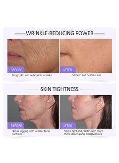 JoyPretty Collagen Serum For Face, Moisturizing Anti-Wrinkles Essence, Skin Brightening, Reduces Fine Lines & Wrinkles, Dark Spot Remove & Skin Brightening, Serums For Skin Care, 1.35 Fl Oz  - Image 5