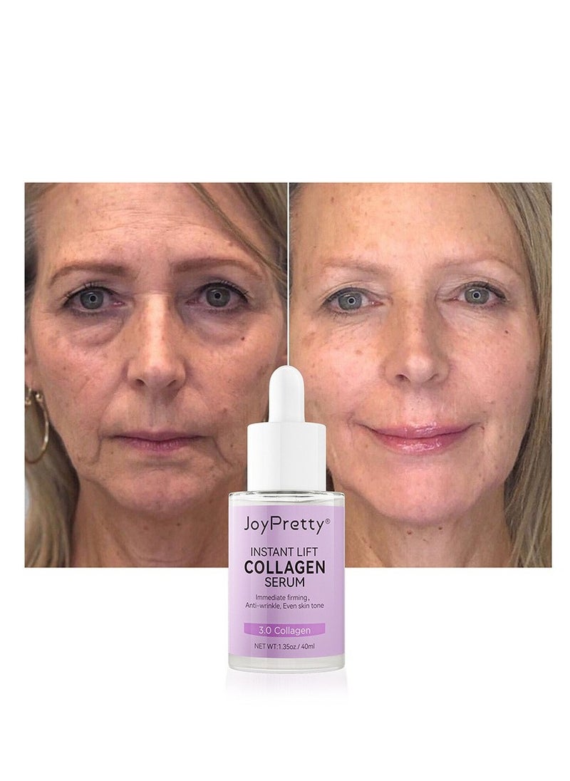JoyPretty - Collagen Serum For Face, Moisturizing Anti-Wrinkles Essence, Skin Brightening, Reduces Fine Lines & Wrinkles, Dark Spot Remove & Skin Brightening, Serums For Skin Care, 1.35 Fl Oz - Image 1