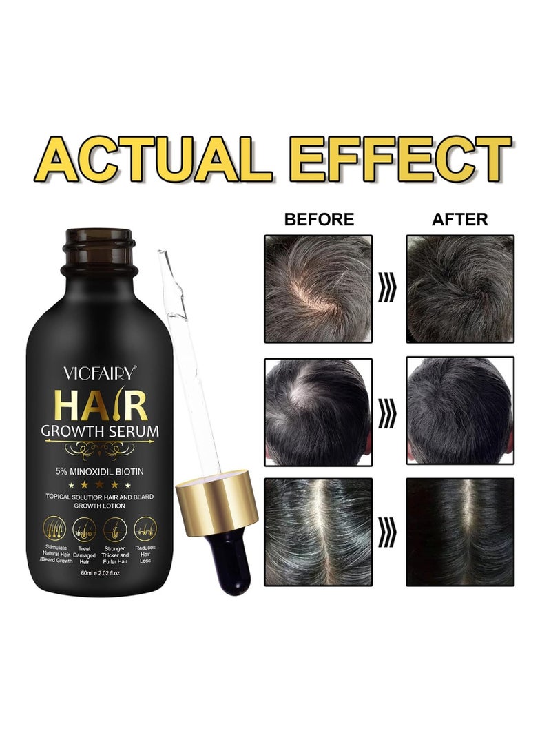 VIOFAIRY - 5% Minoxidil for Men and Women - Biotin Hair And Beard Growth Serum & 5% Minoxidil Treatment for Stronger Thicker Longer – Natural Growth Thickening Treatment - Stop Thinning & Hair Loss-1Month supply - Image 1