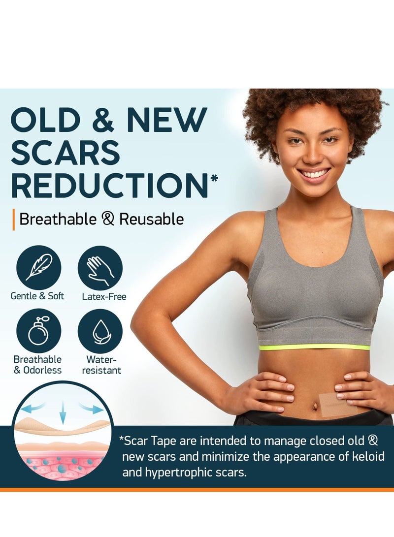 SYOSI Silicone Scar Tape as Sheets, Strips - 1.5"x59" Extra Long - C-Section, Tummy Tuck, Keloid, Acne Removal Treatment - Post Surgery Supplies - Patch, Bandage - Try w/Surgical Silicon Gel - Image 3