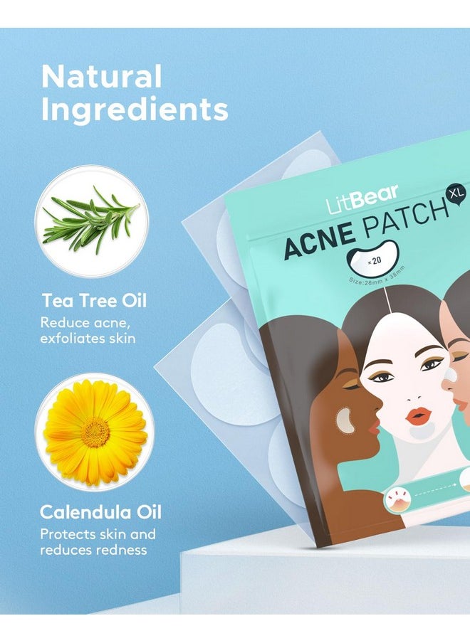 LitBear LitBear Acne Patches Large, Hydrocolloid Pimple Patches for Large Breakouts, Zit and Blemish, Large Acne Patches for Face, Chin, Back and Body with Tea Tree & Calendula Oil  - Image 5