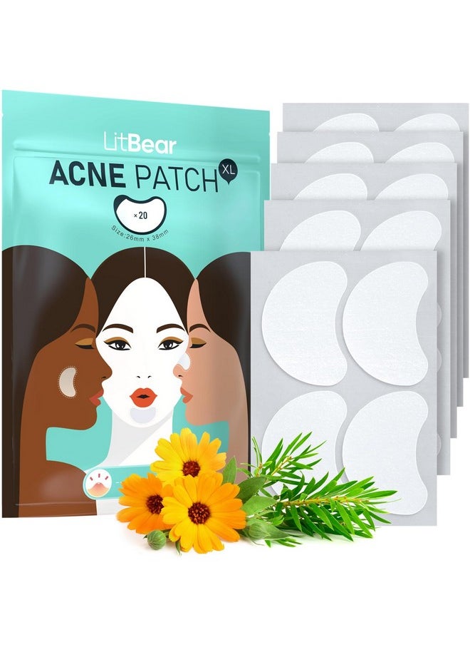LitBear LitBear Acne Patches Large, Hydrocolloid Pimple Patches for Large Breakouts, Zit and Blemish, Large Acne Patches for Face, Chin, Back and Body with Tea Tree & Calendula Oil  - Image 1