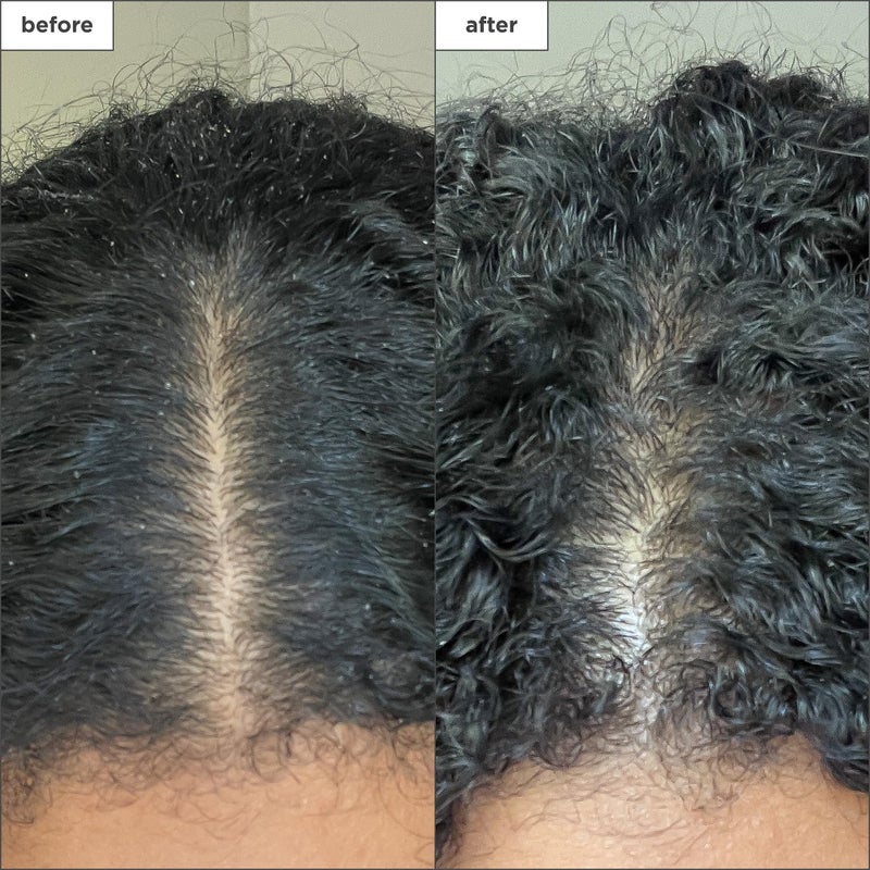 Briogeo Scalp Revival Charcoal + Coconut Oil Micro-Exfoliating Shampoo, Treatment for Dry & Itchy Scalp, Clarifying Shampoo for Build Up, Scalp Scrub for Oily Scalp, Vegan, Cruelty-Free, 8 fl oz - Image 5