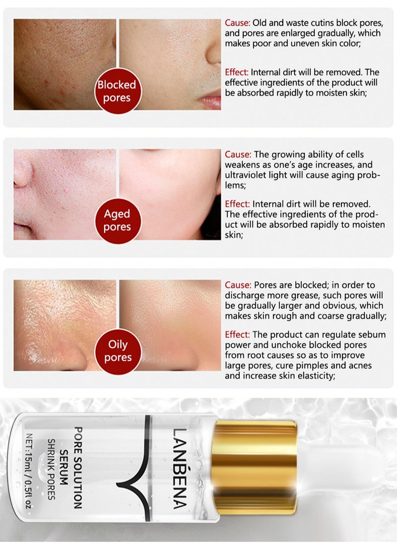 LANBENA - Pore Solution Serum, Facial Serum for Removing Blackheads and Minimizing Pores, Nose Pore Cleansing Essence - 15ml - Image 1