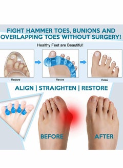 Excefore Gel Toe Separator Toe Stretcher Hammer Toe and Bunion Corrector for Men and Women Correct Your Toes Naturally 4 Pcs  - Image 2