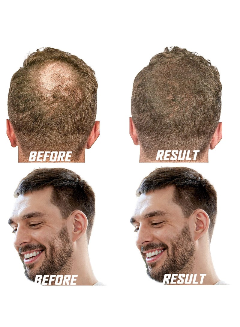 Excefore Derma Roller for Face Body Beard Hair Growth, 3 Pcs Beard Roller for Face Body Hair Skin, Facial Skin Care Tools for Men Women Home Use (#0.5mm, Black+Purple+Red) - Image 5