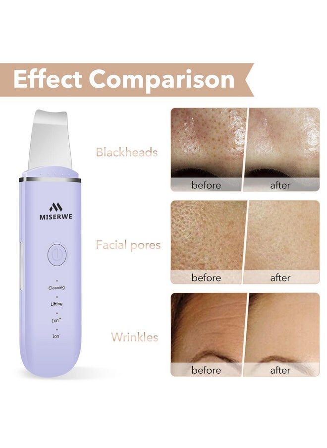 Miserwe - Skin Scrubber Face Skin Spatula Facial Scrubber Spatula For Deep Cleansing Blackhead Remover Pore Cleaner With 4 Modes (Purple) - Image 1