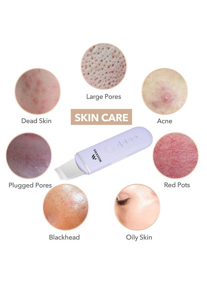 Miserwe - Skin Scrubber Face Skin Spatula Facial Scrubber Spatula For Deep Cleansing Blackhead Remover Pore Cleaner With 4 Modes (Purple) - Image 1