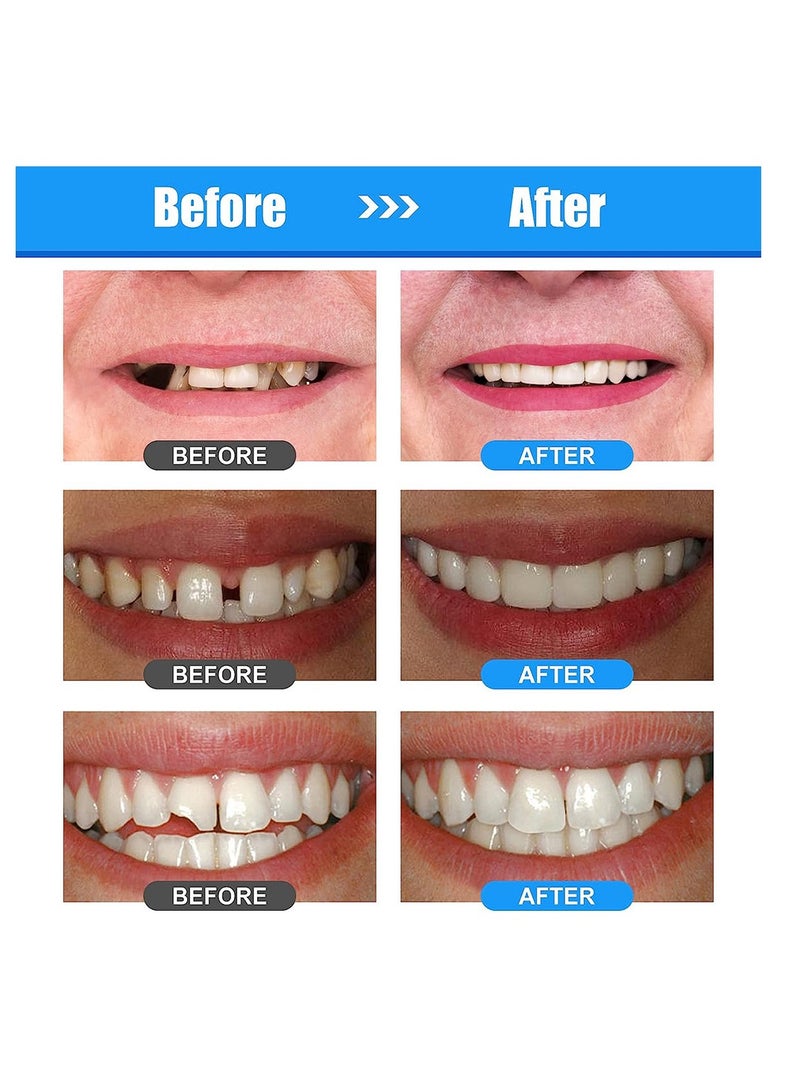 Generic Plastic gutta percha set party makeup temporary filling denture decoration 30ml  - Image 5