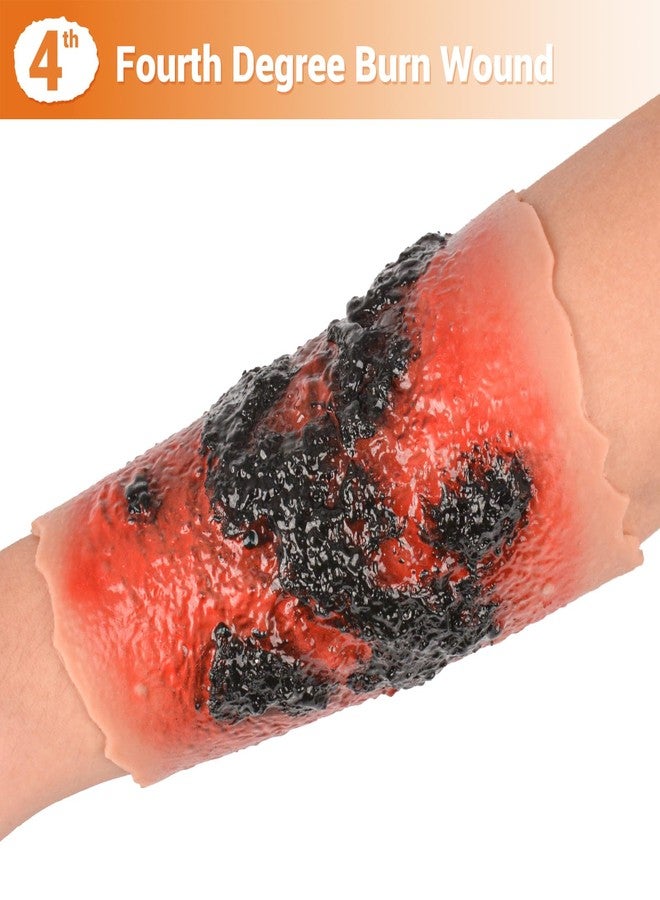MedEduQuest Burn Wound Packing Trainer, Burn Moulage, Adhesive Skin Burn Wound Trainer for Wound Care Training, Fourth Degree Burn Wound Training Model - Image 3
