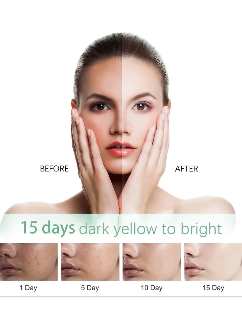 KANGYUAN 120g Whitening Freckle Facial Cleanser Oil Soothing Control Spots Foam Gentle Dark Wash Fad Facial Cleansing - Image 4