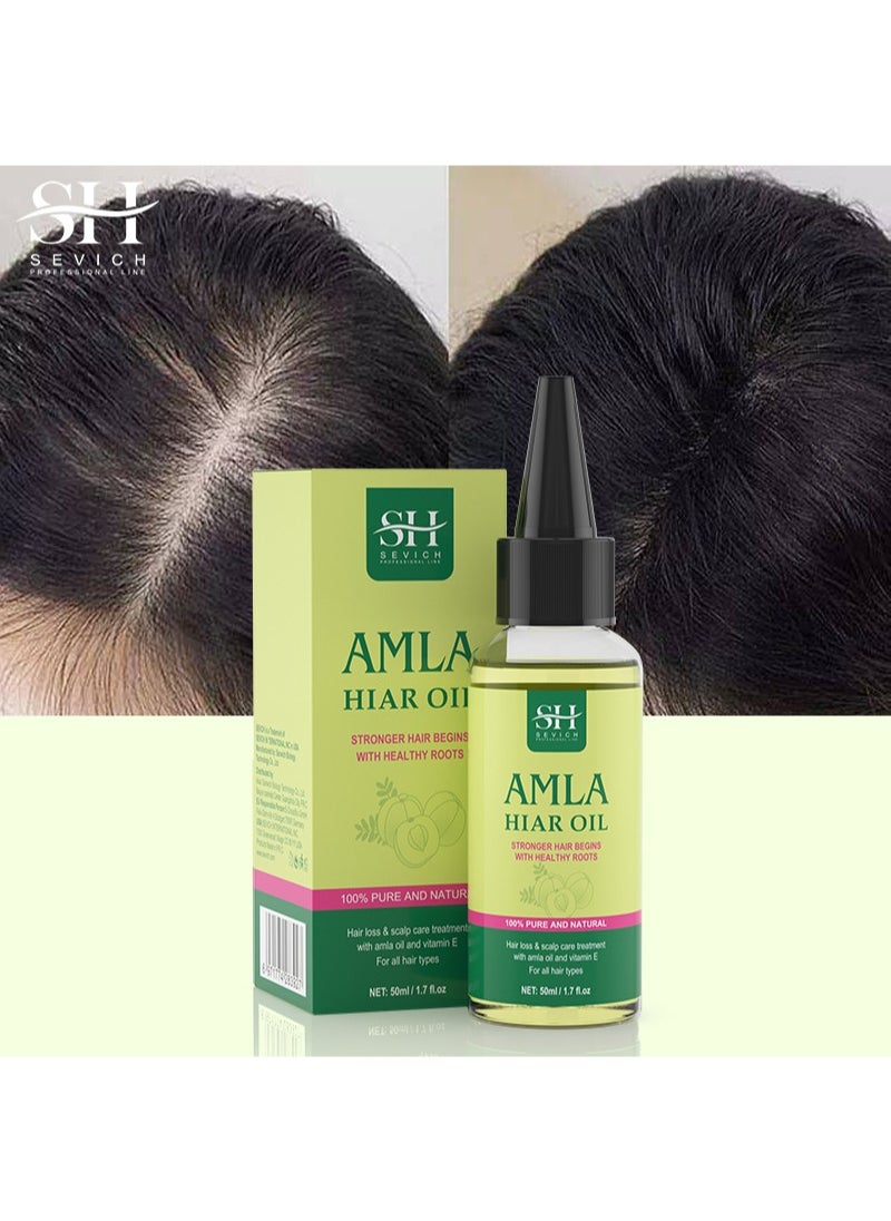 Amla Hiar Oil，Healthy Hair Moisturized Scalp，Natural & Vegan，Promotes Thicker，Fuller, Shinier Hair for Men and Women（50ml）