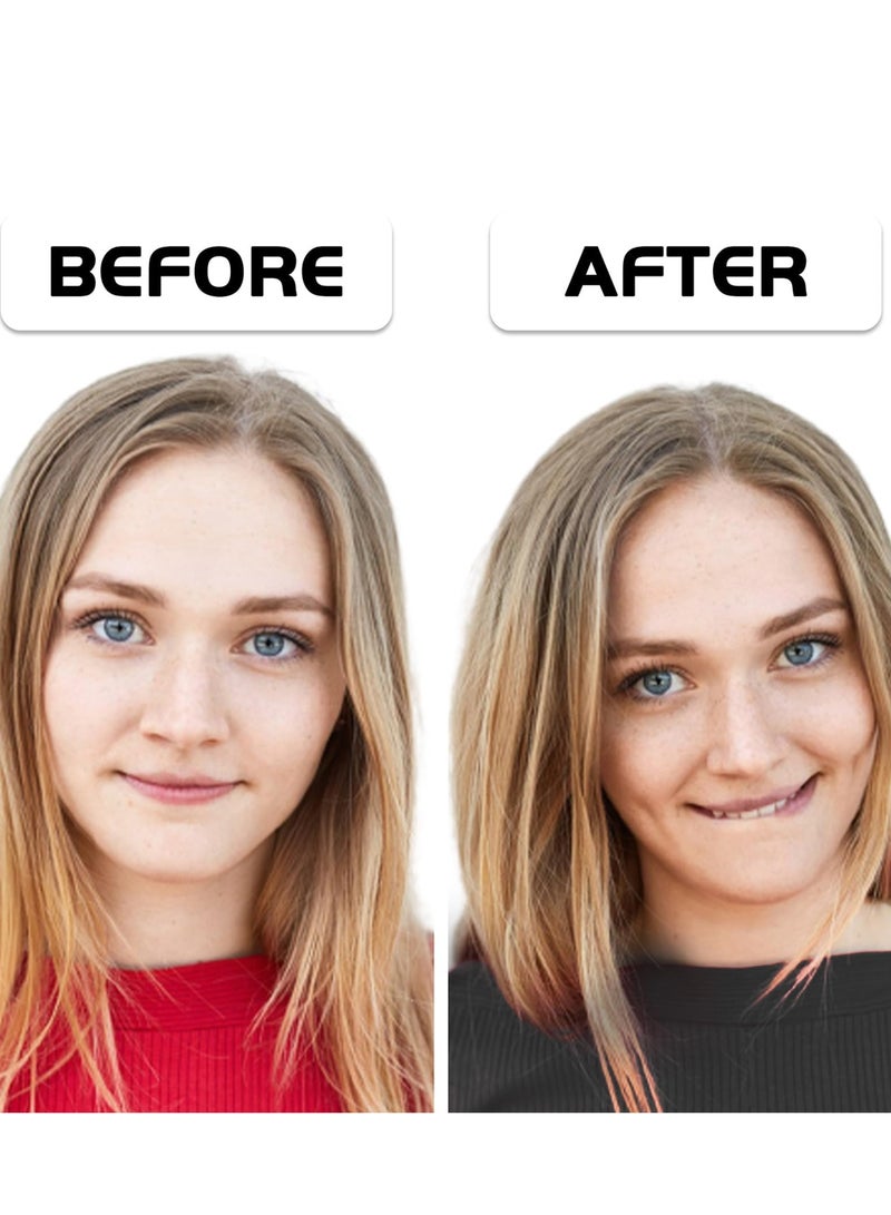 RTYY 4Pcs Dimple Maker, Smile Exerciser Facial Dimple Trainer, Easy to Wear And Develop Natural Dimples for Beautiful Smile - Image 3