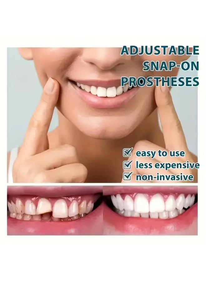 White Adjustable Clip On Denture Set With Tooth Socket Box Upper Lower Jaw Model - Image 4