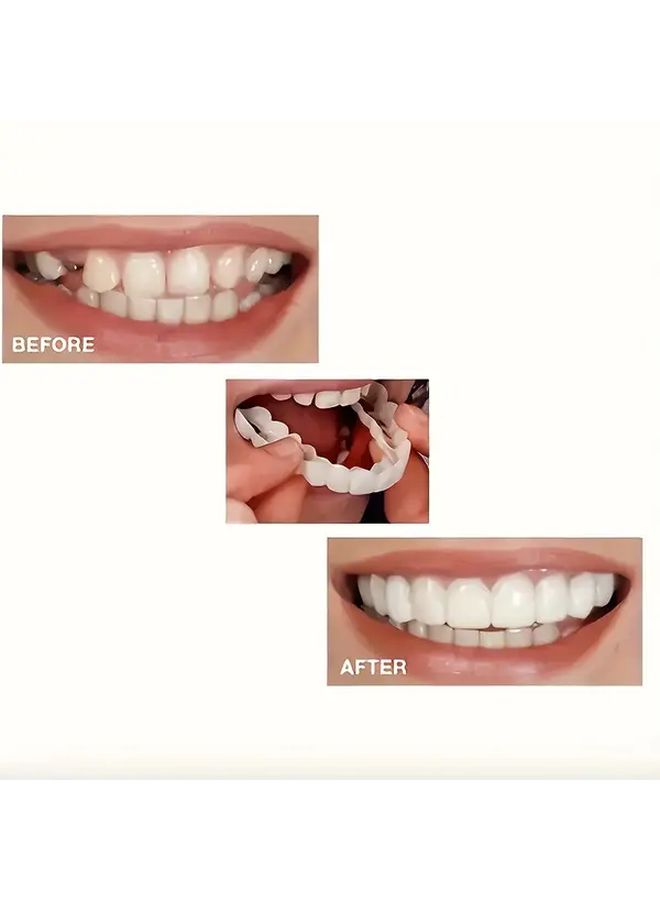 White Adjustable Clip On Denture Set With Tooth Socket Box Upper Lower Jaw Model - Image 3
