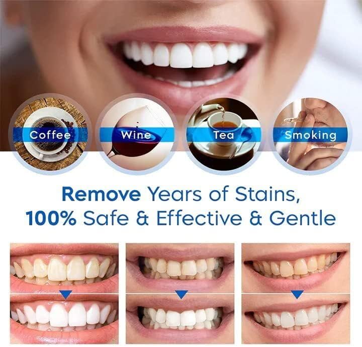 Lanthome Teeth Whitening Essence Pen, Teeth Stain Remover to Whiten Teeth (5) 5 - Image 3