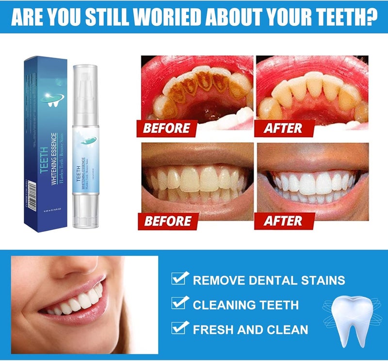 Lanthome Teeth Whitening Essence Pen, Teeth Stain Remover to Whiten Teeth (5) 5 - Image 2