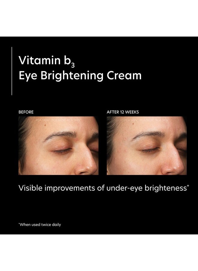PCA SKIN Vitamin B3 Eye Brightening Cream Eye Brightener For Bright Eyes Dark Circles Wrinkles And Uneven Skin Tones Anti Aging Eye Cream Formulated With Niacinamide 1 Oz Tube  - Image 2